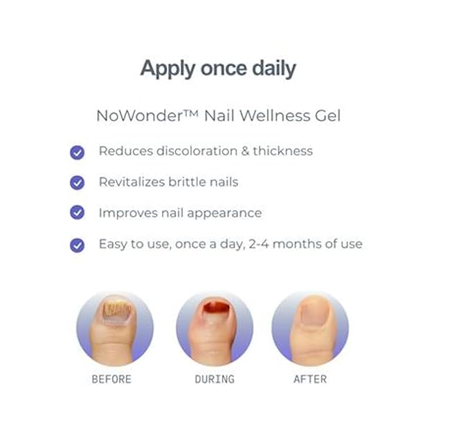 NoWonder Nail Wellness Gel | Nitric Oxide Creating Nail Renewal Solution | Supports Clearer, Healthier Nails | Non-Prescription, Safe & Easy-to-use, Nail Care, with Visible Results