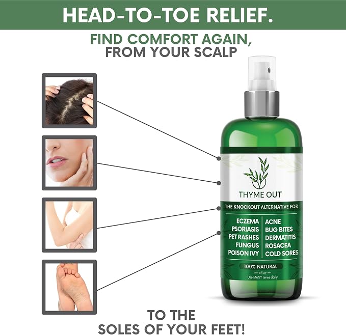 Thyme Out All Natural Eczema Treatment- Psoriasis Treatment - an All-in-One Solution for Acne, Dermatitis, Rosacea, Cold Sores, Bites, Poison Ivy - Anti-Itch Spray for Itchy Skin Relief 4oz